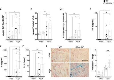 Semaphorin 7A is protective during inflammatory peritonitis through integrin receptor signaling